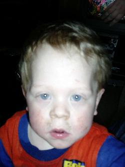 Thomas
